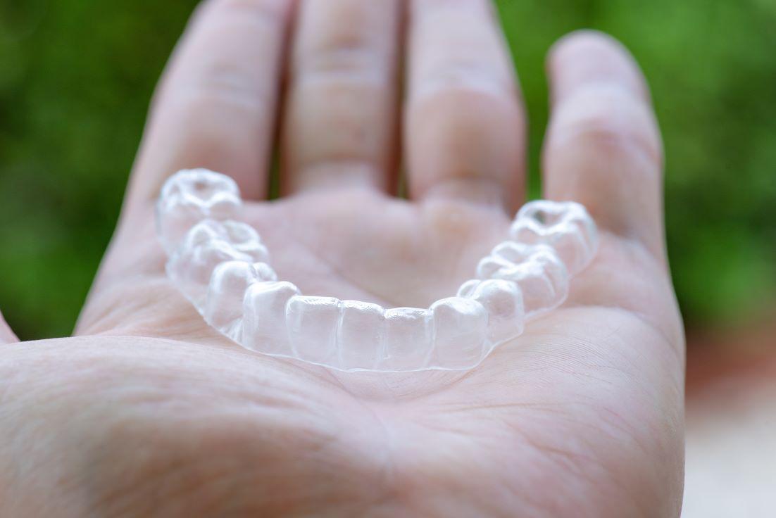 What Happens if Your Skip Wearing Aligners?